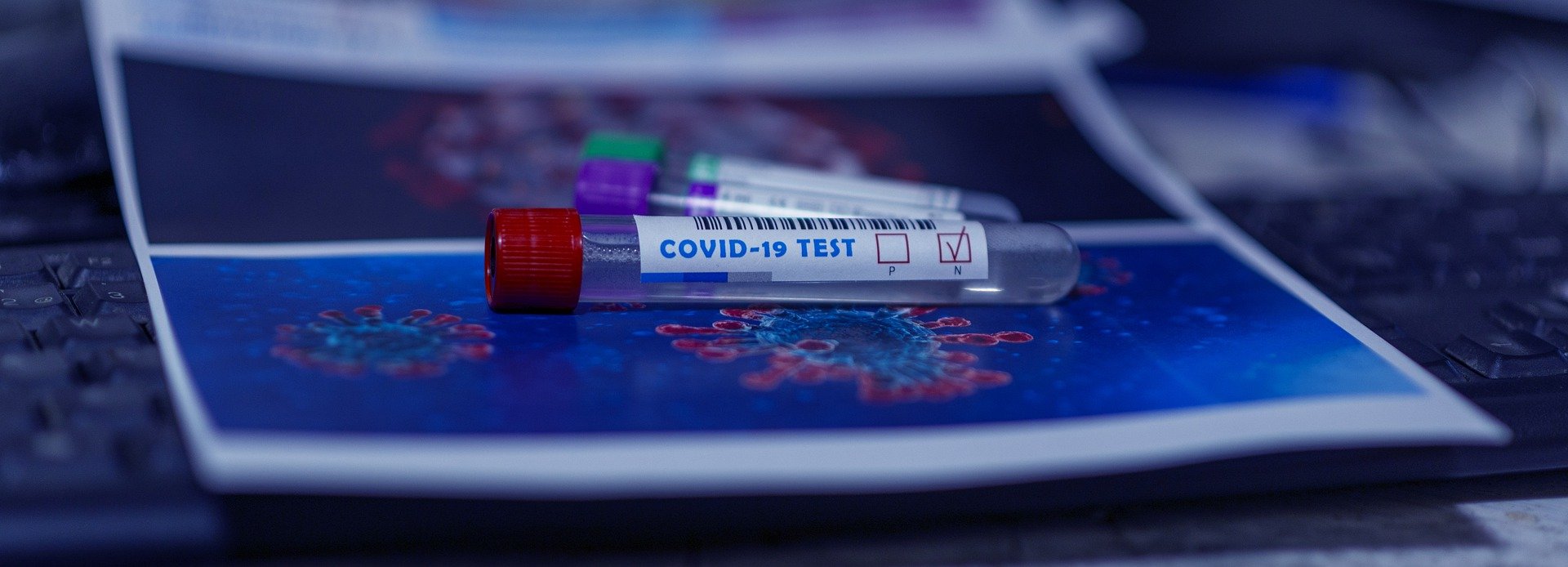 Hétőn kezdődik településünkön az általános iskolai, óvodai és bölcsődei dolgozók koronavírus-tesztelése